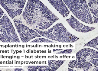 The islets of Langerhans play a crucial role in blood sugar regulation. Fayette A Reynolds/Berkshire Community College Bioscience Image Library via Flickr